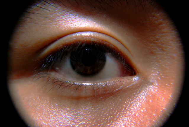 eyeball